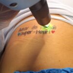 Remoção de Tatuagem e Micropigmentação em Sorocaba | Marília Giordano