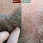 Remoção de Micropigmentação Capilar em Sorocaba | Marília Giordano